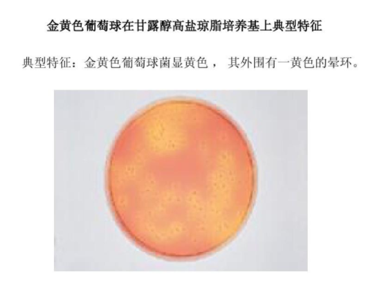 金黄色葡萄球菌培�ȝ���? /><span style=